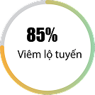 Viêm lộ tuyến