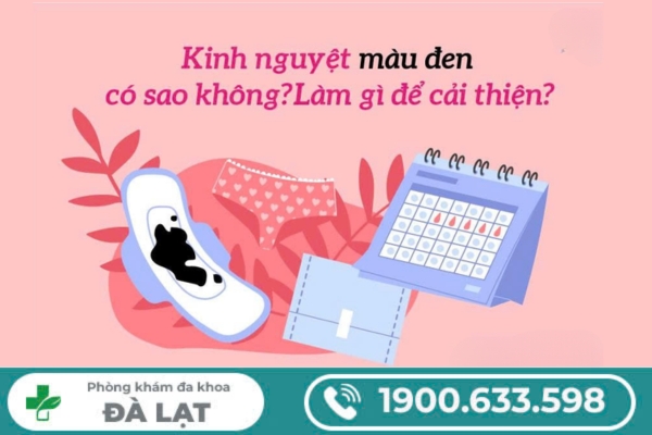 Hình ảnh minh họa