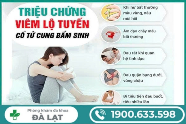 Hình ảnh minh họa