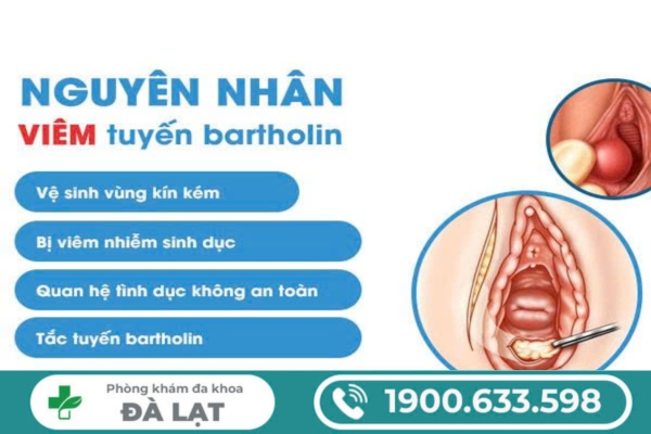 Hình ảnh minh họa