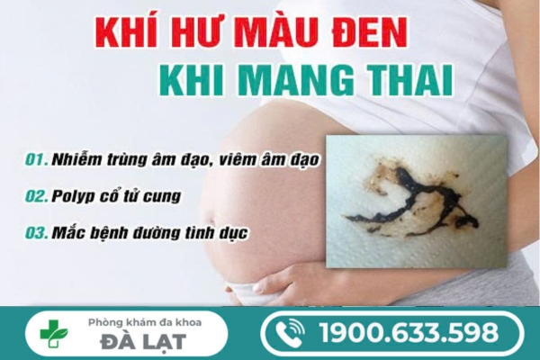 Hình ảnh minh họa