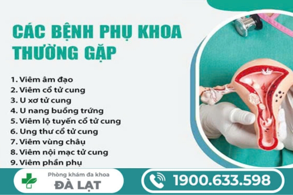 Hình ảnh minh họa