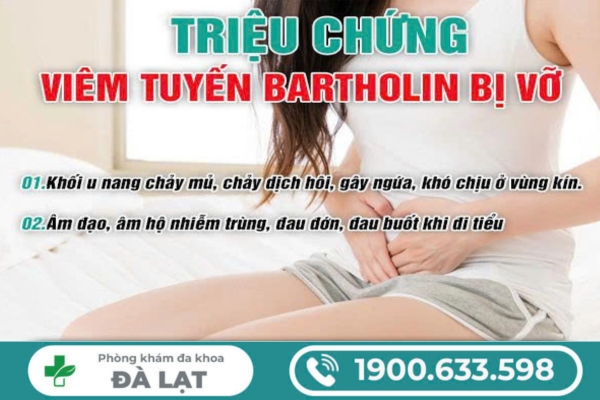 Hình ảnh minh họa