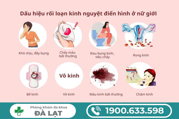 Hình ảnh minh họa