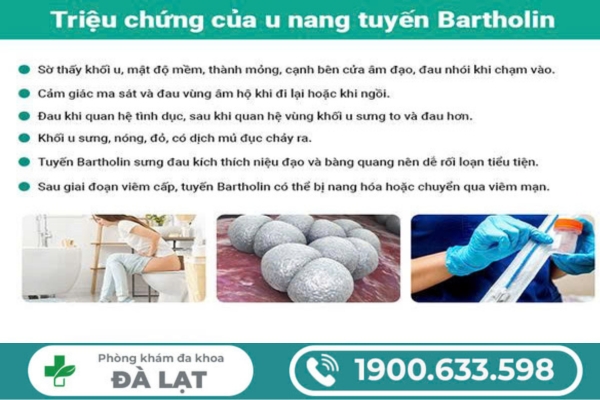 Hình ảnh minh họa