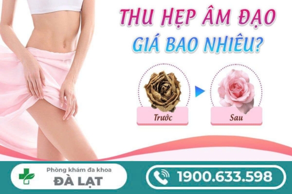 Hình ảnh minh họa