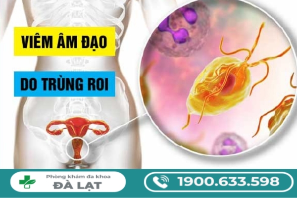 Hình ảnh minh họa