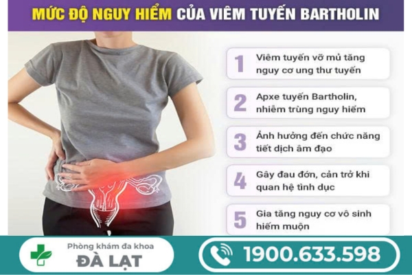 Hình ảnh minh họa