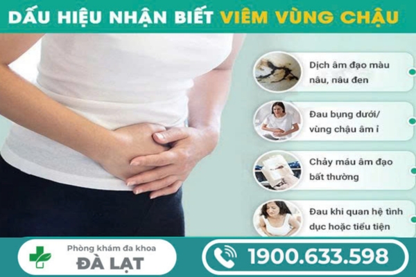 Hình ảnh minh họa