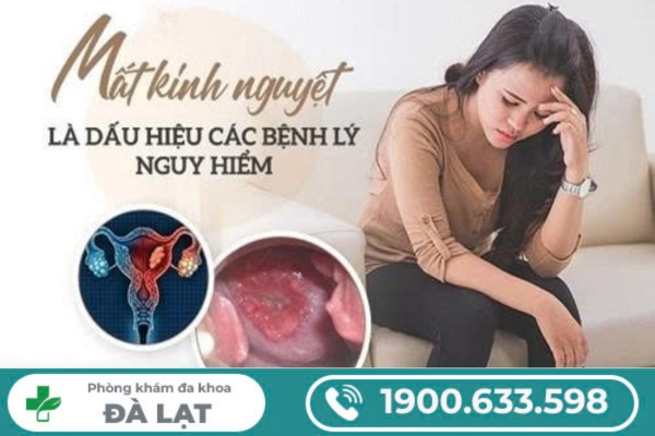 Hình ảnh minh họa