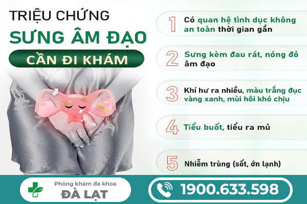 Hình ảnh minh họa