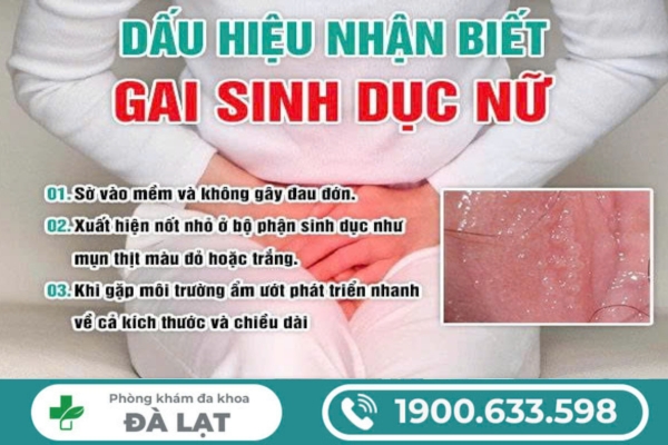 Hình ảnh minh họa