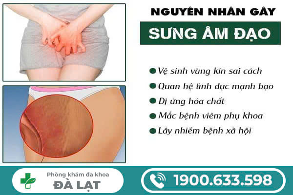 Hình ảnh minh họa