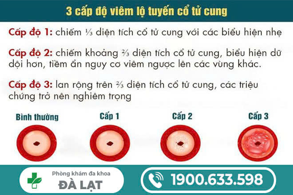 Hình ảnh minh họa