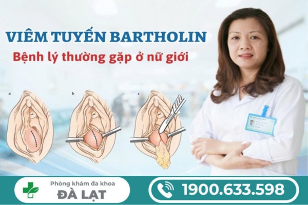 Hình ảnh minh họa