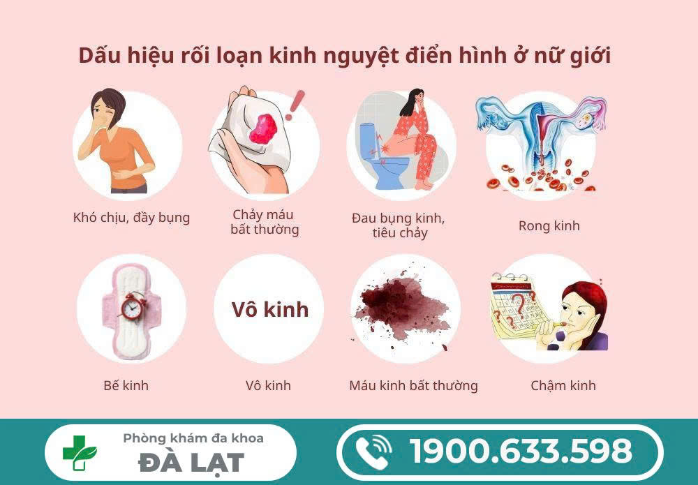 Hình ảnh minh họa