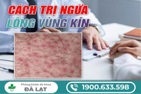 Hình ảnh minh họa