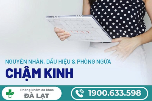Hình ảnh minh họa