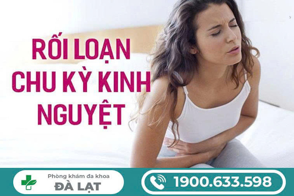 Hình ảnh minh họa