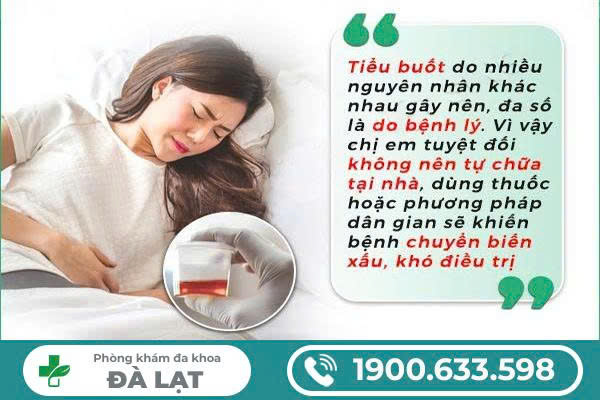 Hình ảnh minh họa