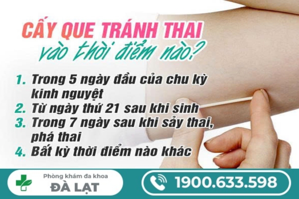 Hình ảnh minh họa