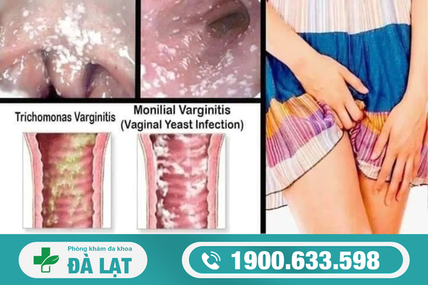 Hình ảnh minh họa