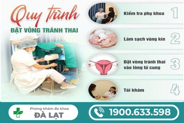 Hình ảnh minh họa