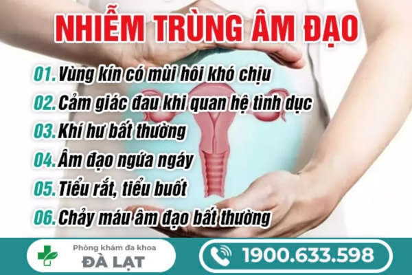 Hình ảnh minh họa