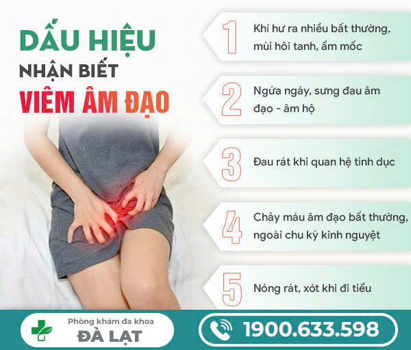 Hình ảnh minh họa