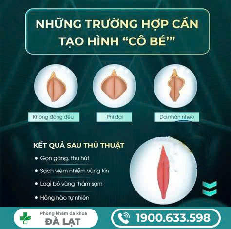Hình ảnh minh họa