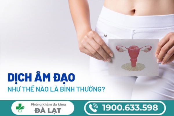 Hình ảnh minh họa