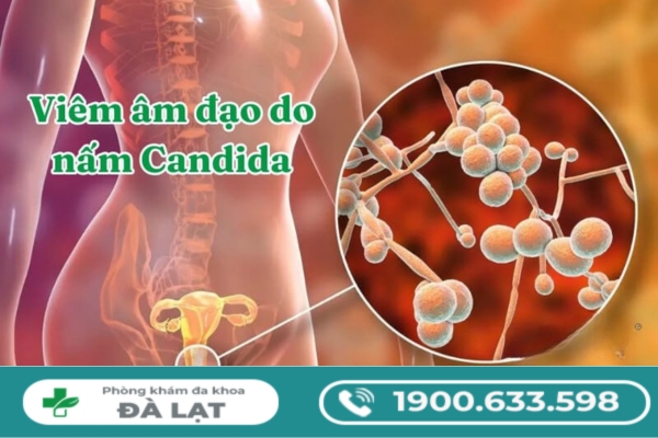 Hình ảnh minh họa