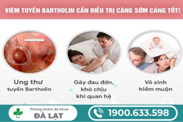 Hình ảnh minh họa