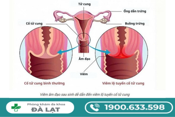 Hình ảnh minh họa