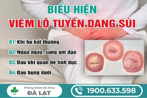 Hình ảnh minh họa