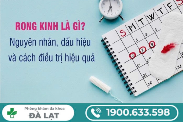 Hình ảnh minh họa