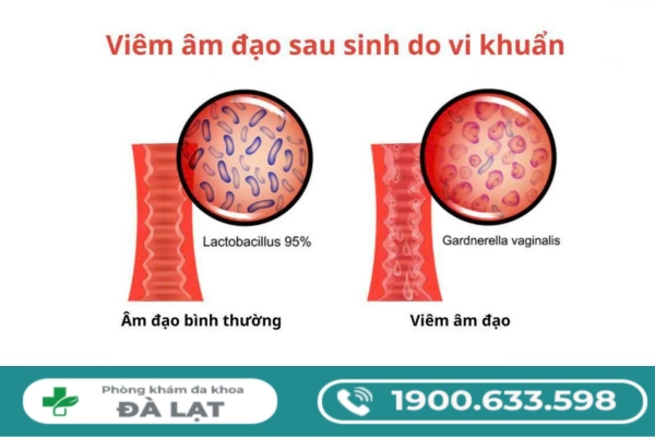 Hình ảnh minh họa