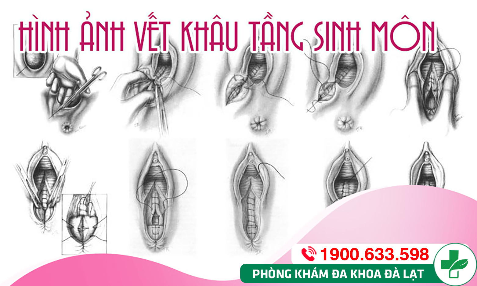 Hình ảnh minh họa