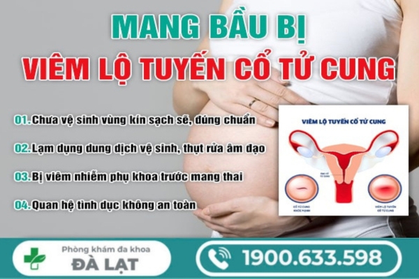 Hình ảnh minh họa