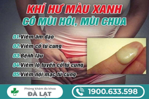 Hình ảnh minh họa