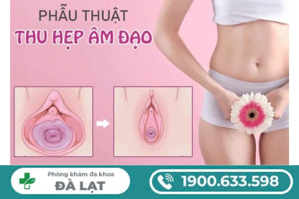 Hình ảnh minh họa