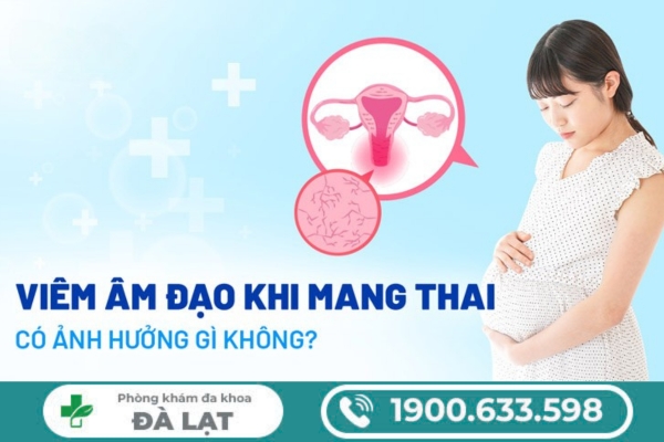 Hình ảnh minh họa