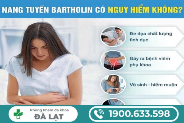 Hình ảnh minh họa