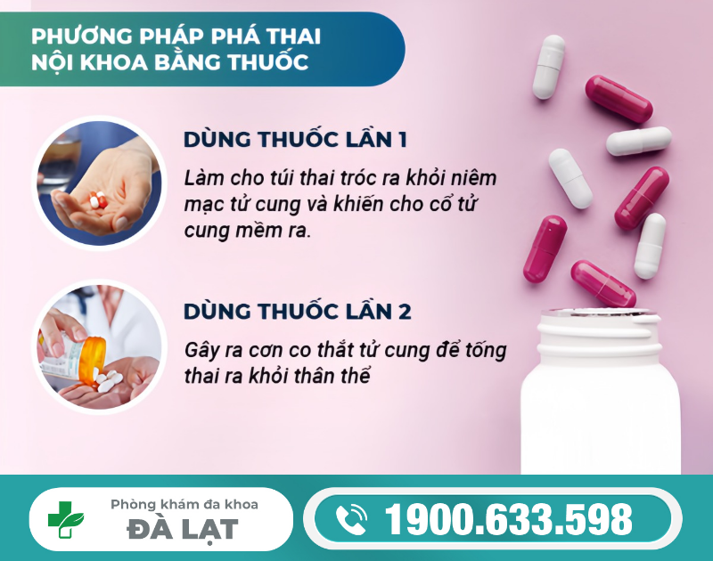 Hình ảnh minh họa