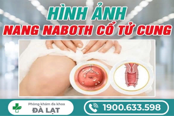 Hình ảnh minh họa