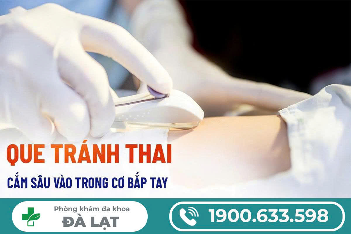 Hình ảnh minh họa