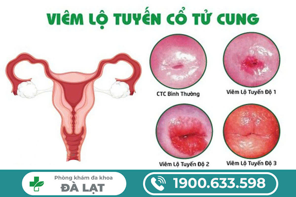 Hình ảnh minh họa