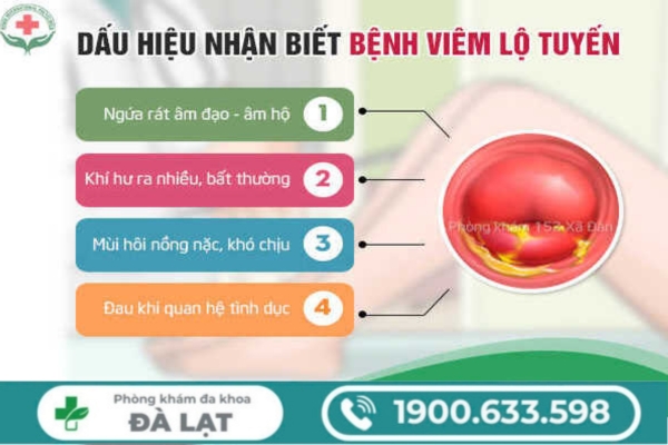 Hình ảnh minh họa