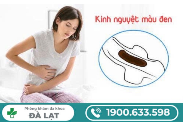 Hình ảnh minh họa