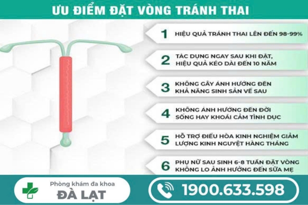 Hình ảnh minh họa